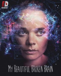 مشاهدة مشاهدة وتحميل فيلم My Beautiful Broken Brain 2014 مترجم